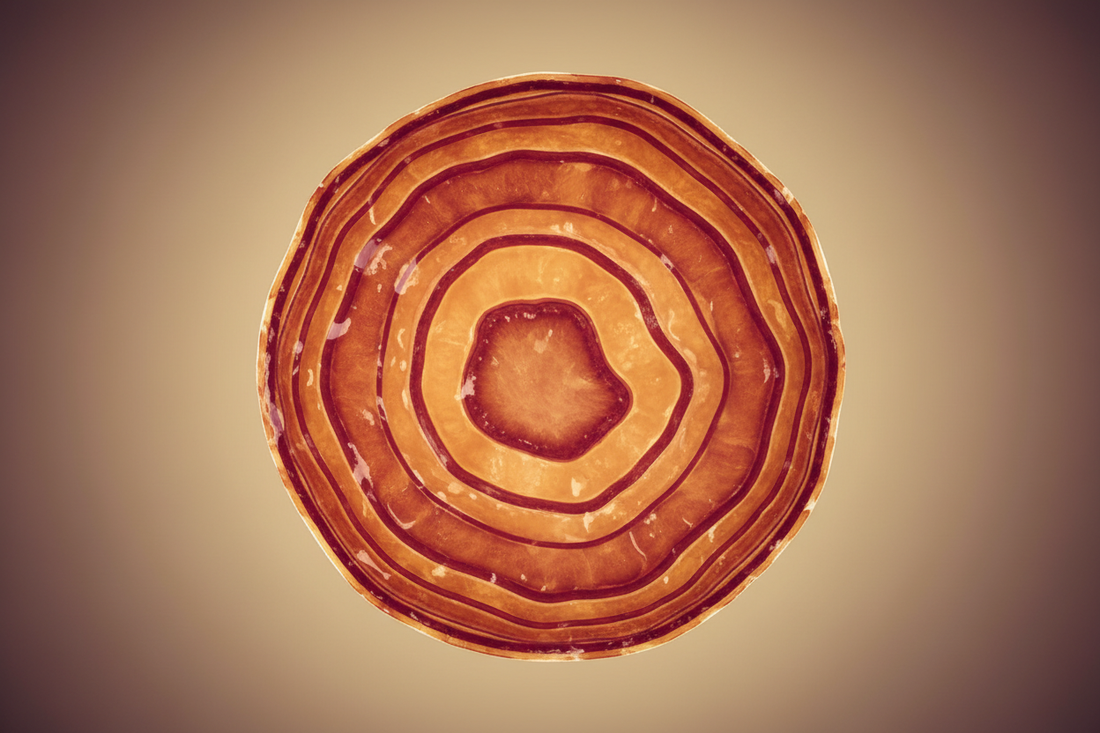 Atherosclerosis: The Inflammatory Root Cause Framework