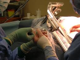 Can a Biopsy Cause Cancer to Spread? What the Research Really Says