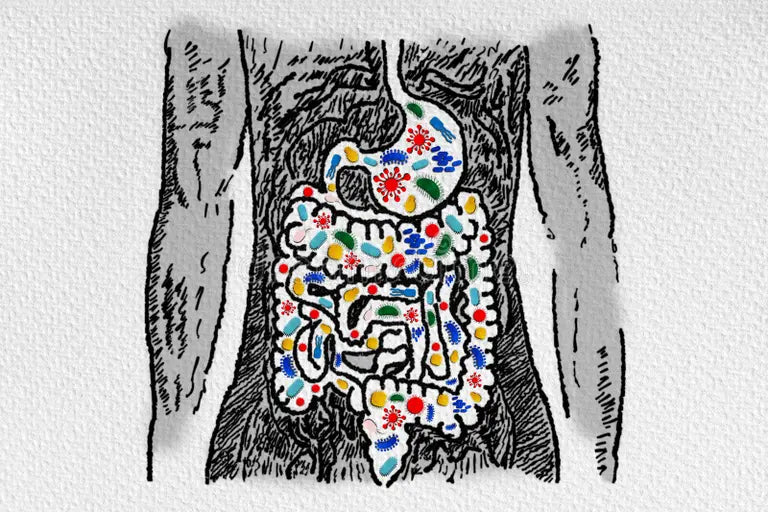 Scientific illustration of the gut microbiome showing diverse bacteria and connections to cancer risk pathways
